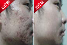 ������ɽҽԺ�����һ�����