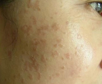 Ȫ�ݱ�ƽ��������õ�ҽԺ���ļ�