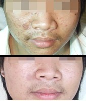 ����ǰ��Ա�