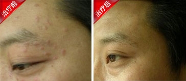 ��ƽ����������