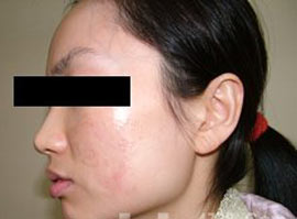 ������Ƥ����ô����