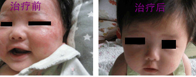 Ƥ����������