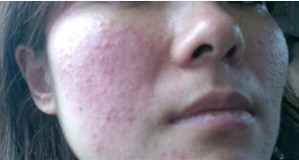 Ƥ������������ô����