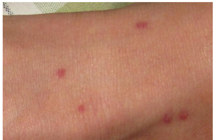 身上长红点不疼不痒需要治疗吗